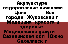 Акупунктура, оздоровление пиявками › Цена ­ 3 000 - Все города, Жуковский г. Медицина, красота и здоровье » Медицинские услуги   . Сахалинская обл.,Южно-Сахалинск г.